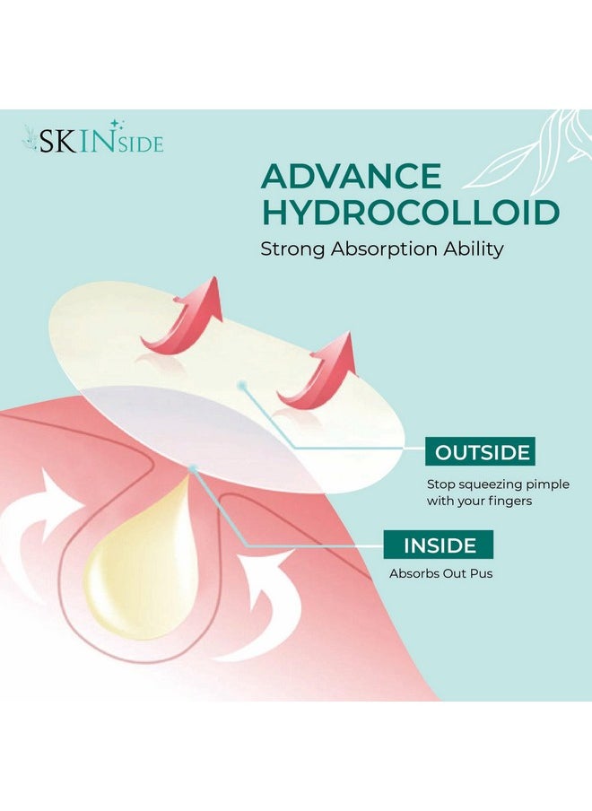 Skinside - Acne Pimple Patches For Face Pimples (72 Patches) Hydrocolloid Facial Patches With 0.5% Salicylic Acid For Pimple Healing | Invisible Waterproof Absorbs Excess Oil Overnight (72 Patches) - Image 1