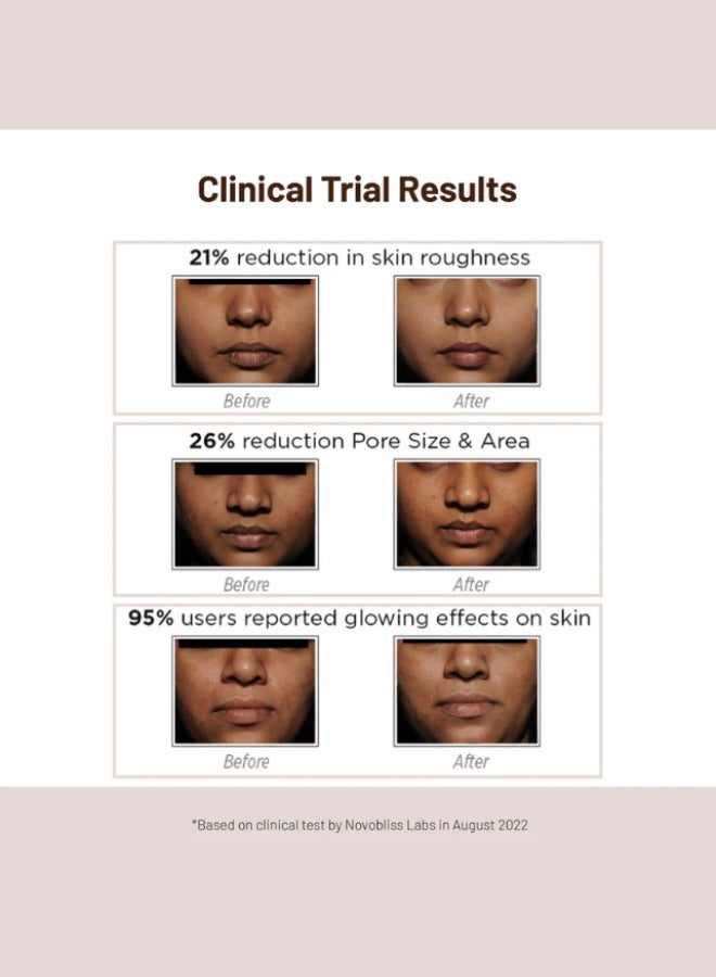 SkinQ Glow Bright Mask 60Gm  With Vitamin C & Niacinamide; Fights Pigmentation Tan Dead Cells & Dark Spots; Facial Clay Mask- Unisex -Instant Glow in 15 Minutes -From Authorised Dealer In UAE - Image 4