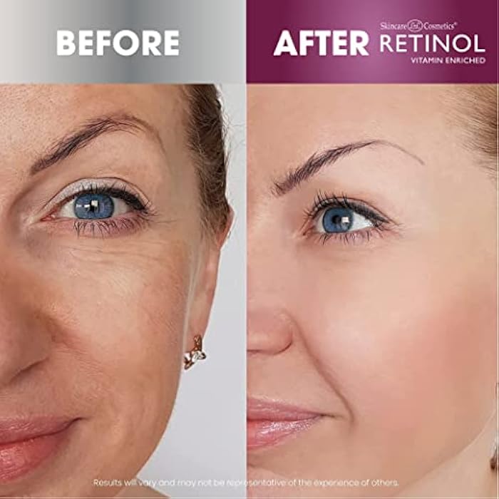 RETINOL كريم الليل والنهار المضاد للشيخوخة من ليفورا - غني بالفيتامينات - ثنائي العناية بالبشرة الخاص بك لمدة 24 ساعة الذي يعمل ليلاً ونهاراً ليمنحك بشرة تبدو أصغر سناً، 1 أونصة لكل منهما - Image 4