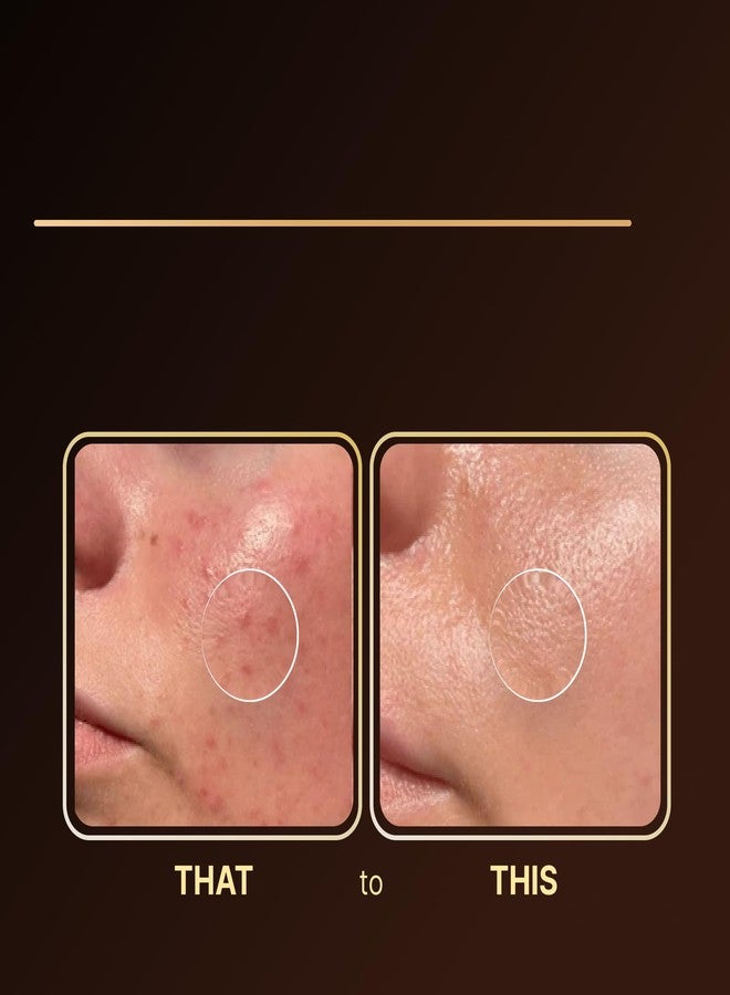 ذا سييل كريم عسل دهن البقر المغذى على العشب من سيل للوجه والجسم - كريم مرطب عميق للبشرة مع العسل وزبدة الشيا - بلسم مرطب للبشرة الجافة والحساسة - مرطب يومي خفيف الوزن، 1.7 أونصة سائلة. - Image 4