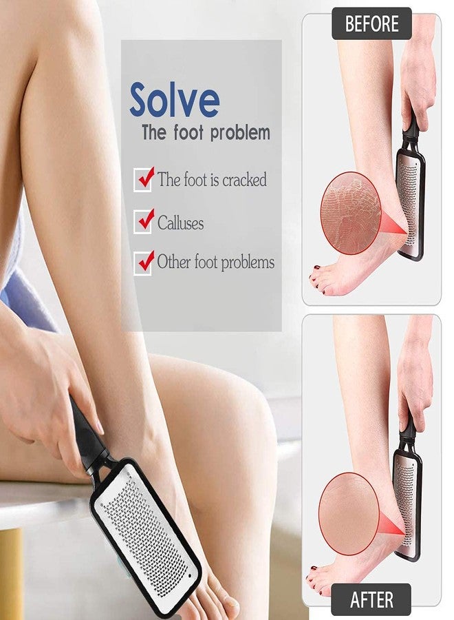 TWIREY Foot File Callus Remover Pedicure Tool Remove Hard Skin Multi use Pedicure Paddle Brush - Image 4