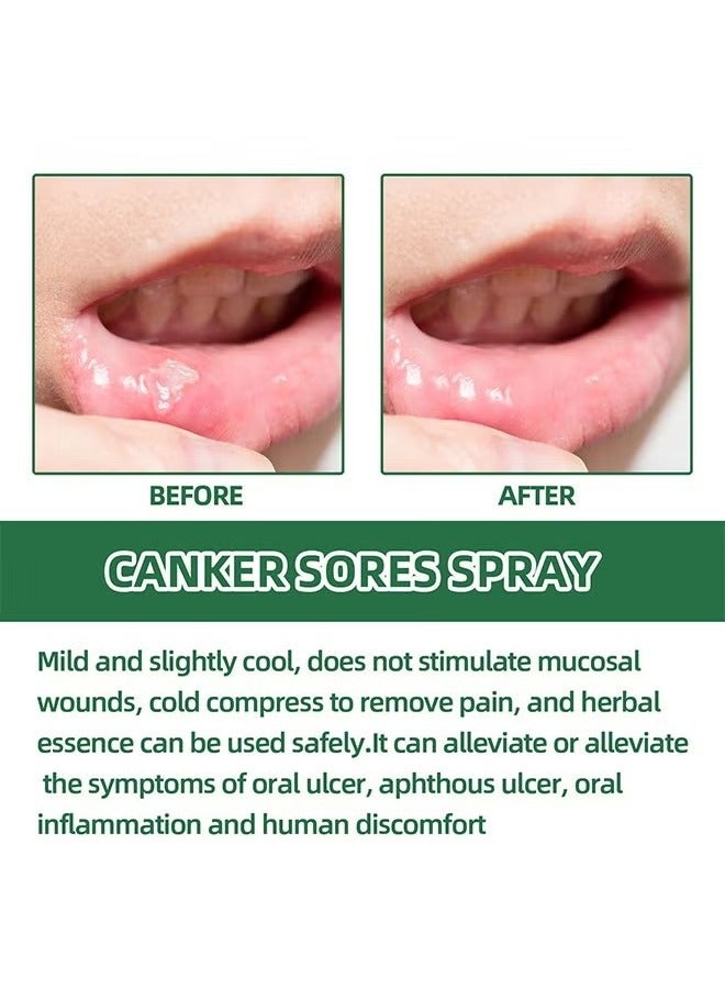 SOUTH MOON SOUTH MOON Canker Sore Treatment Spray 20ml，Herbal Ulcer Treatment,Natural Mouth Sore Relief for Daily Oral Care, Mouth Spray,Treat Mouth Ulcer,Effective Mouth Sore TreatmentSOUTH MOON Canker Sore Treatment Spray 20ml，Herbal Ulcer Treatment,Natural Mouth Sore Relief for Daily Oral Care, Mouth Spray,Treat Mouth Ulcer,Effective Mouth Sore Treatment - Image 3