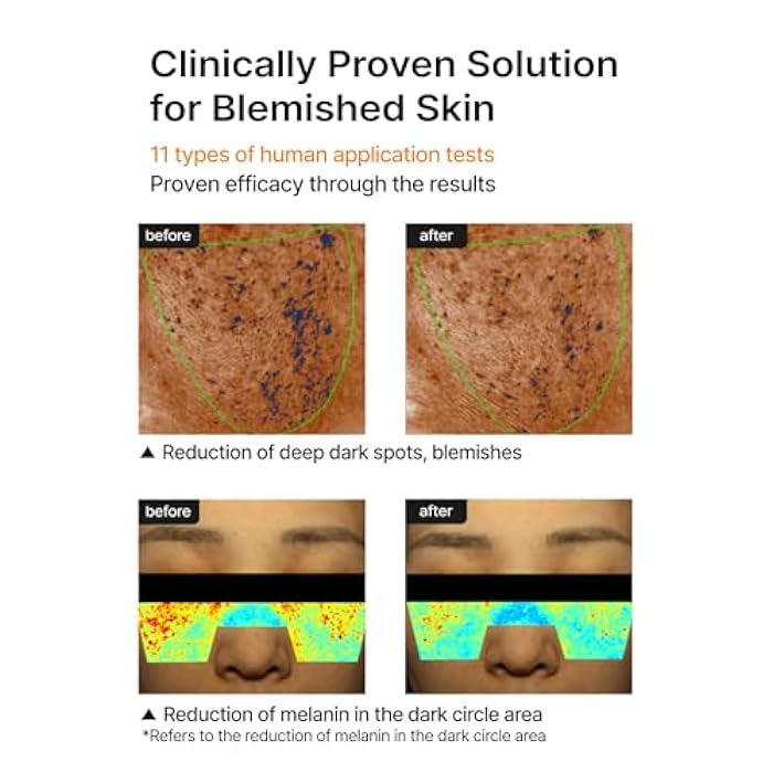 celimax Pore + Dark Spot Brightening Cream - Image 5