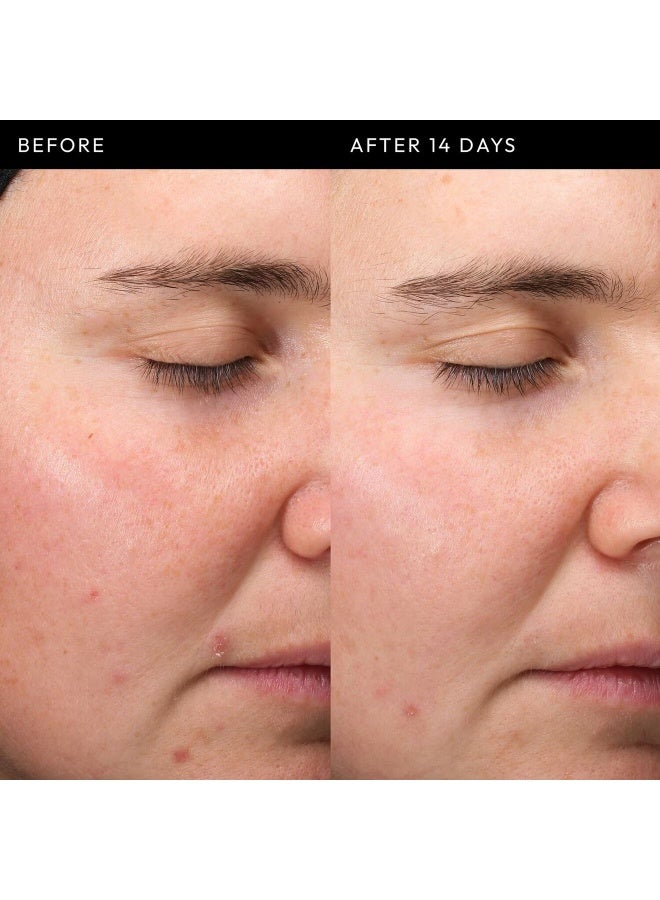 The Inkey List Exosome Hydro-Glow Complex - Image 4