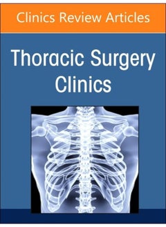Robotic Thoracic Surgery, An Issue of Thoracic Surgery Clinics (Volume 33-1) 