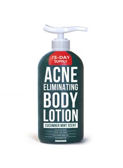 TreeActiv TreeActiv Acne Eliminating Body Lotion, 8 fl oz, Salicylic Acid Lotion, Salicylic Acid Body Acne Treatment, Back Acne Treatment Cream for Women and Men, Acne Lotion for Body, Zit Cream with 2000+ Uses  - Image 1