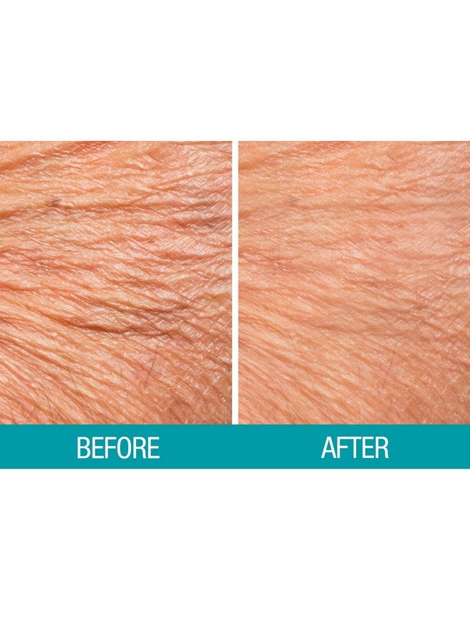 ديرماكتين كريم ديرماكتين كريب لشد البشرة 2.5 أونصة - Image 4