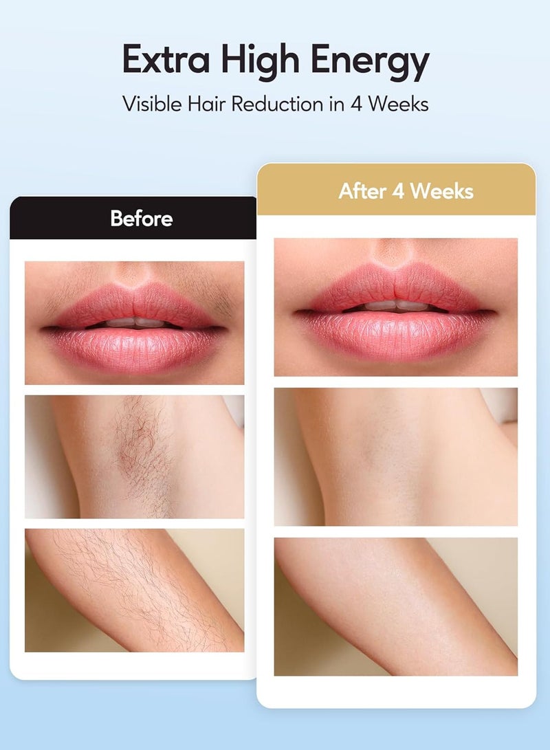 Generic IPL Hair Remval Device with Ice Cooling Function,999999 Flashes 9 Level Painless Long Lasting Hair Remover System for Facial,Bikini,Body  - Image 3