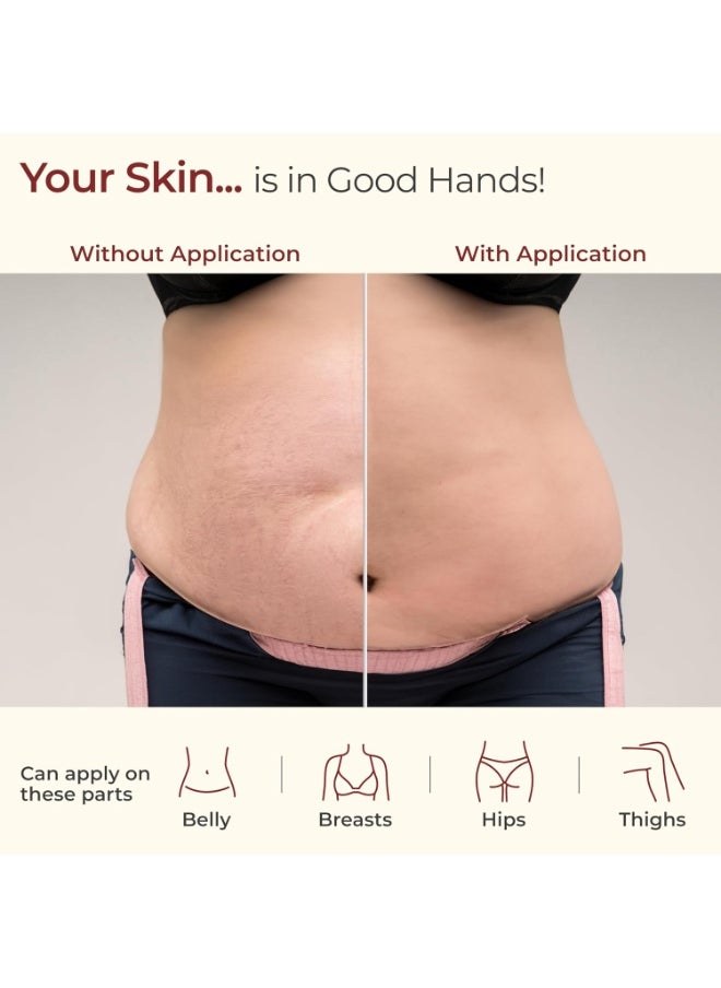 Luvlap Stretch Mark Oil for Pregnant Women, Stretch Mark Removal & Prevention, Enriched with Onion Oil, Calendula Oil & Vitamin E, Dermatologically Tested, Safe during Pregnancy, 80ml  - Image 5