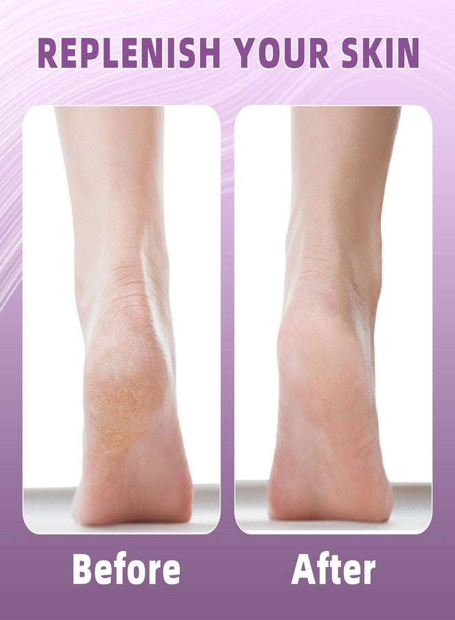 Untrytb 2 Pairs Silicone Socks for Dry Cracked Feet Women, Moisturizing Heel Socks, Gel Toeless Lotion Sock, Moisture Silicon Foot Sock for Cracked Heels Overnight by Untrytb - Image 5