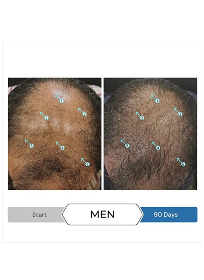 DS LABORATORIES - Spectral.UHP 5% Minoxidil Hair Growth Serum for Men by DS Laboratories Extra Strength Topical Hair Loss Treatment Supports Hair Growth in the Vertex Experience Fuller Thicker Hair - Image 1