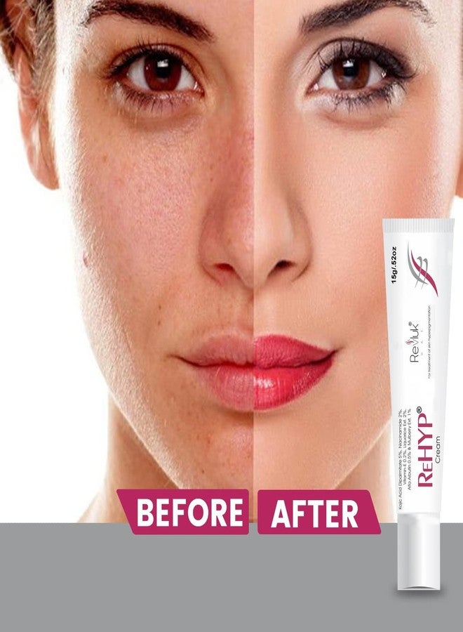 Revluk Rehyp Pigmentation Cream for Women - Dark Spot Remover, Brightening Face Cream with Kojic Acid & Alpha Arbutin - Paraben-Free, Dermatologically Tested - 15g - Image 5