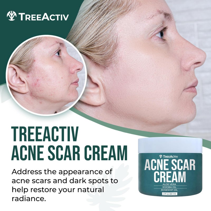 TreeActiv كريم تري أكتيف لعلاج آثار حب الشباب، 2 أونصة سائلة، كريم للندبات للوجه ومزيل للبقع الداكنة، لوشن لعلامات التمدد والجسم، إزالة آثار حب الشباب لجميع أنواع البشرة، 500+ استخدام - Image 2