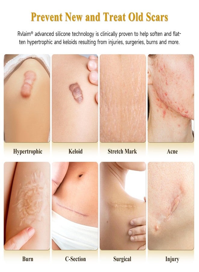 Rvlaim Scar Cream Silicone Scar Gel, Scar Cream for Surgical Scars, Advanced Scar Removal Cream for C-Section, Injury, Acne, Burns, Keloids, Stretch Marks, Old & New Scars, 1.85 Oz (55g - Image 2