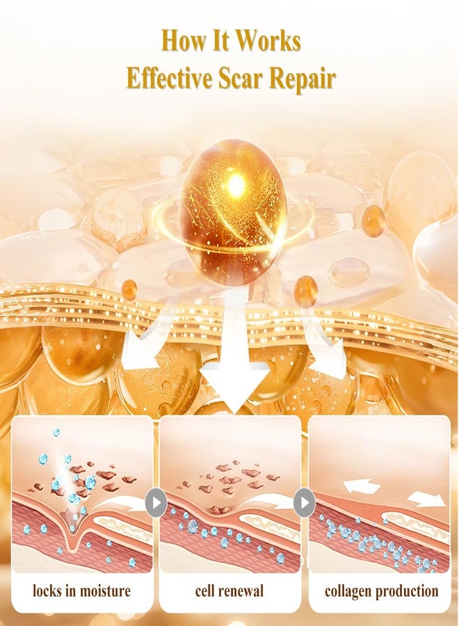 Rvlaim Scar Cream Silicone Scar Gel, Scar Cream for Surgical Scars, Advanced Scar Removal Cream for C-Section, Injury, Acne, Burns, Keloids, Stretch Marks, Old & New Scars, 1.85 Oz (55g - Image 5
