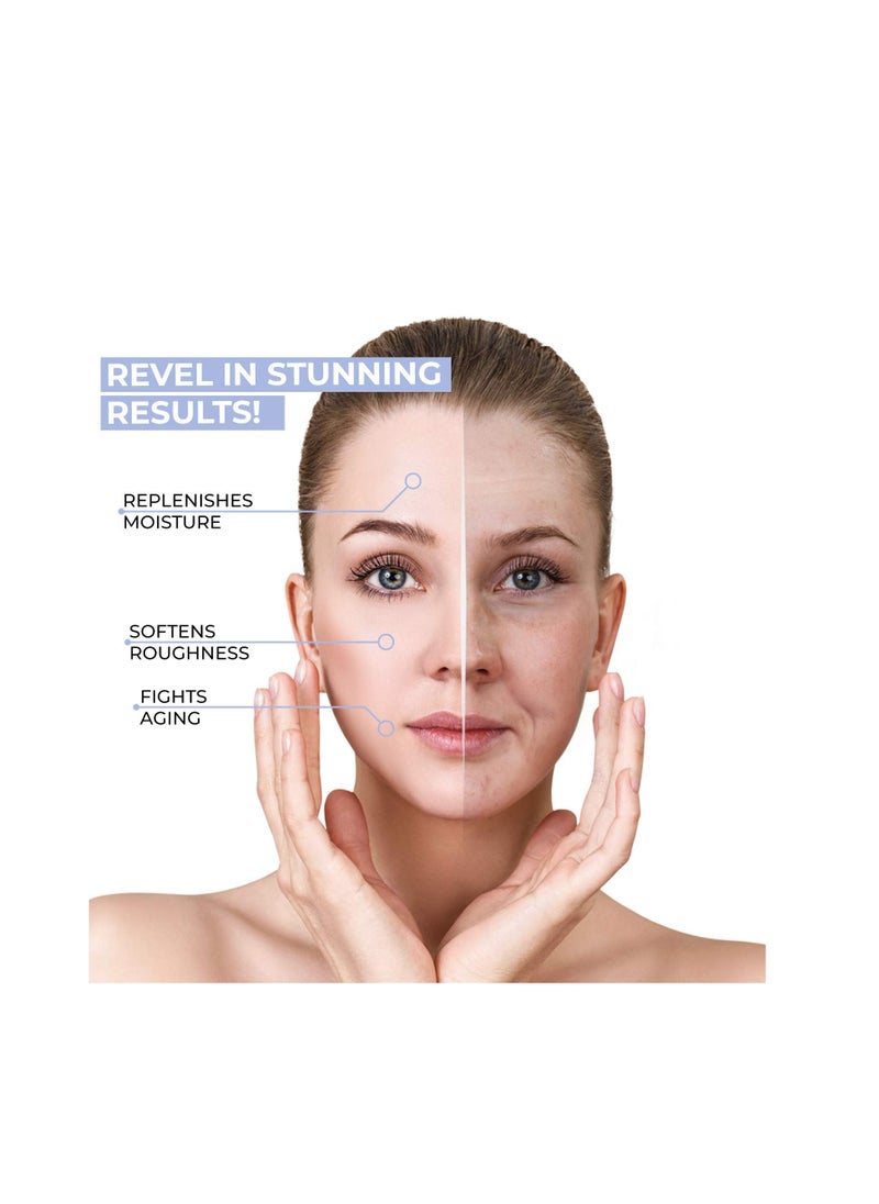 Advanced Clinicals - Moisture Boost Hyaluronic Extra Dry Skin Gel Cream 59 ml - Image 1