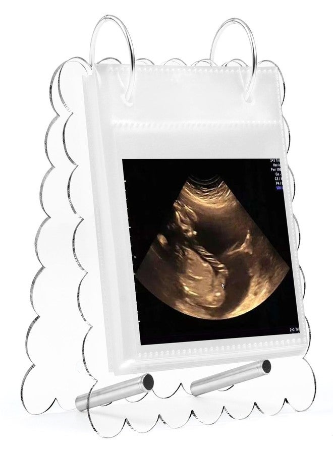 Mlatnod Flip Ultrasound Photo Album with Stand, Refillable Flip-Through Display for 3x4 Pictures, Acrylic Scalloped Cover, Pregnancy Gift for New Parents (Small) - Image 1