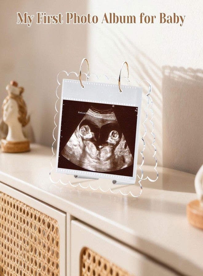 Mlatnod Flip Ultrasound Photo Album with Stand, Refillable Flip-Through Display for 3x4 Pictures, Acrylic Scalloped Cover, Pregnancy Gift for New Parents (Small) - Image 2