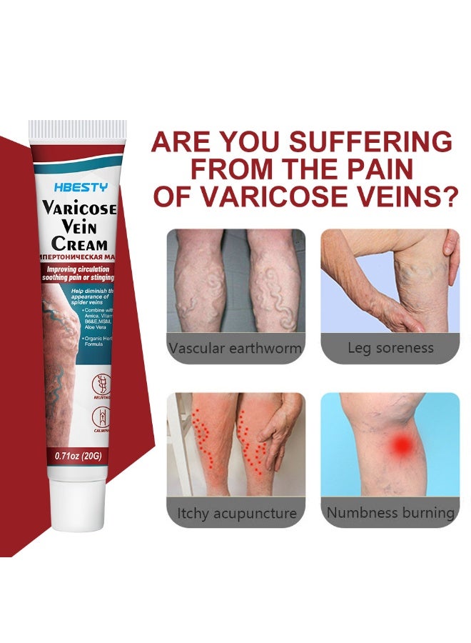 HBESTY 2-PACKS Varicose Veins Soothing Cream, Reduces Varicose Veins, Relieves Swelling and Pain Care Cream 20g*2  - Image 4