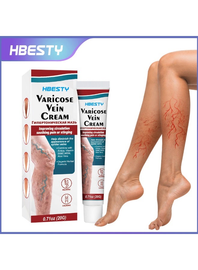 HBESTY 2-PACKS Varicose Veins Soothing Cream, Reduces Varicose Veins, Relieves Swelling and Pain Care Cream 20g*2  - Image 2
