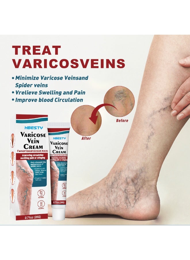 HBESTY 2-PACKS Varicose Veins Soothing Cream, Reduces Varicose Veins, Relieves Swelling and Pain Care Cream 20g*2  - Image 3