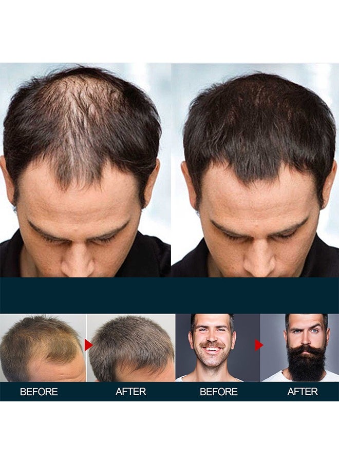 East Moon Extra Strength Hair Regrowth Serum 60ml，Hair Regrowth Treatment For Stronger, Thicker Longer Hair，Stops Hair Thinning (3 Pack)  - Image 5