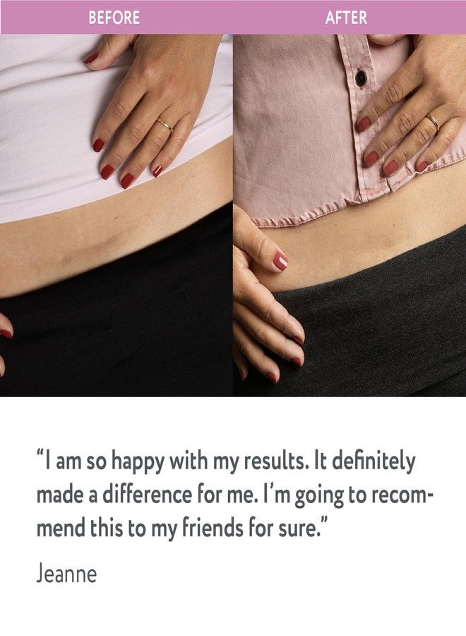 ScarAway Advanced Silicone Scar Sheets for C-Section, Reusable Strips (1.5” x 7”) for Hypertrophic and Keloid Scars from C-Section & Other Surgeries, 4 Sheets - Image 5