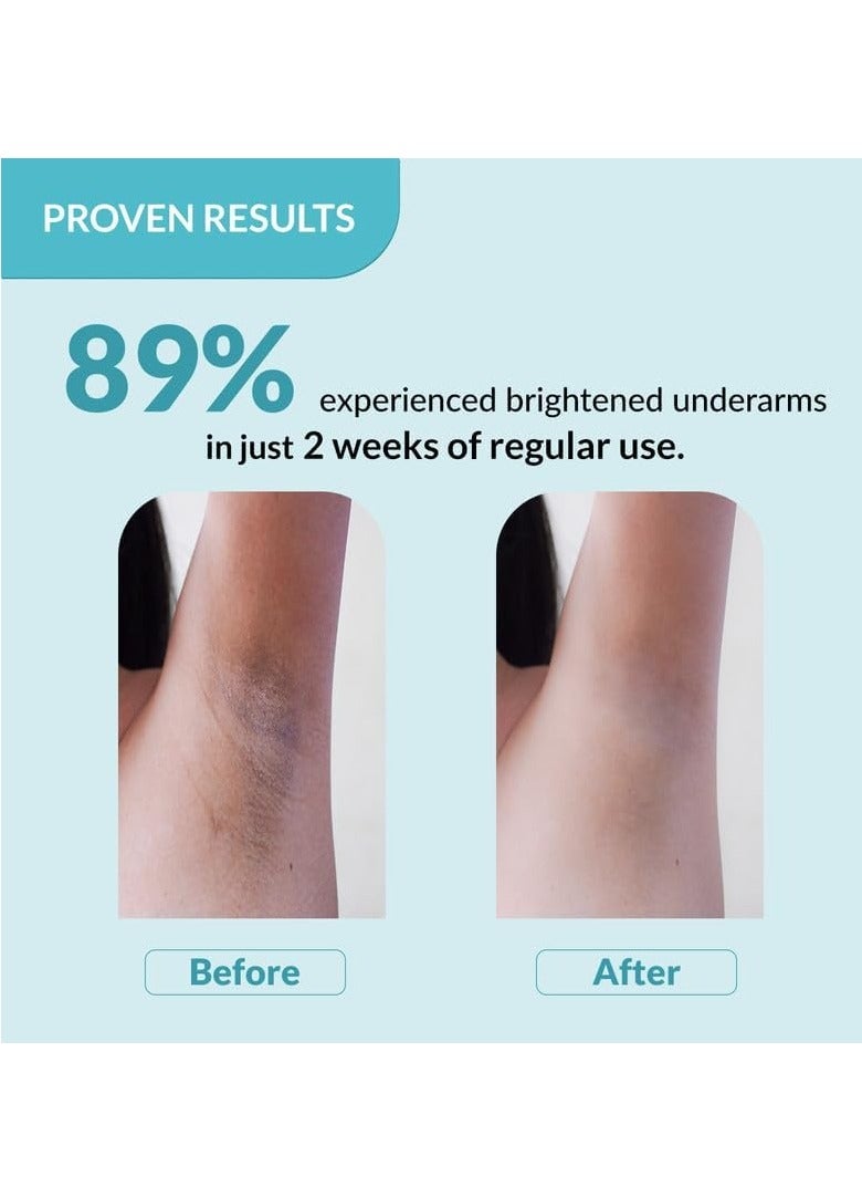 FIXDERMA Nigrifix Underarm Lightening Roll on with 6% AHA, Lactic Acid & 1% Mandelic Acid & Kojic Acid | Brightens Skin & Exfoliates Underarm | For Sensitive Skin - 120ml (Pack of 2) - Image 4