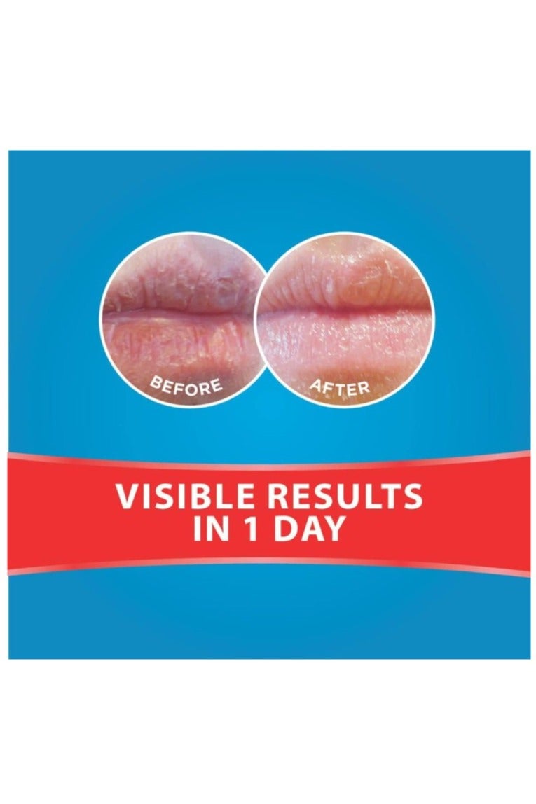 Flexitol Lip Balm Tub 10g - Image 3