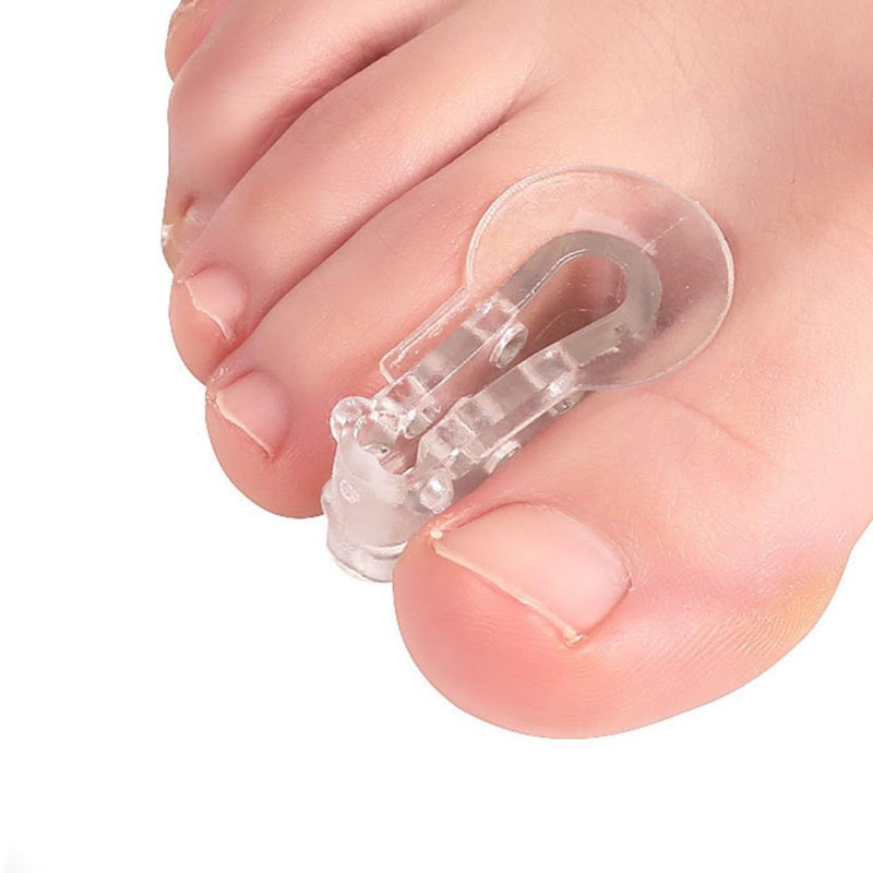 Toe Separators and Bunion Corrector 6 Pack with Overlapping Spacers for Hallux Valgus Relief - Image 5