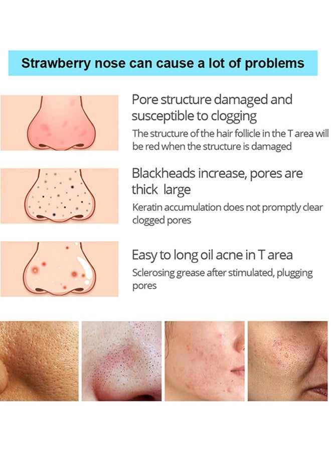 فايبرنت جلامور مزيل قناع الرؤوس السوداء فحم الخيزران ، قناع أسود مقشر بالفحم ، تنظيف عميق للوجه والأنف ، مسام الرؤوس السوداء ، حب الشباب ، تنقية الوجه وتنظيف الرؤوس السوداء 30 جرام - Image 4