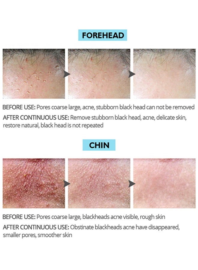 فايبرنت جلامور مزيل قناع الرؤوس السوداء فحم الخيزران ، قناع أسود مقشر بالفحم ، تنظيف عميق للوجه والأنف ، مسام الرؤوس السوداء ، حب الشباب ، تنقية الوجه وتنظيف الرؤوس السوداء 30 جرام - Image 5