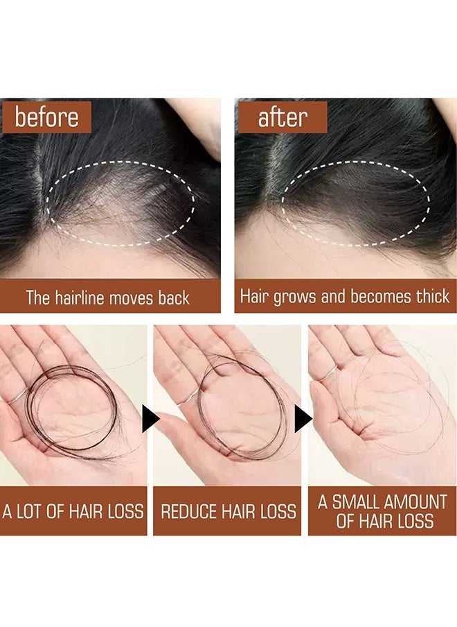 EELHOE - Batana Oil For Hair Growth Healthier Thicker Fuller Hair, Batana Oil, Batana Oil For Hair Growth, Batana Oil Organic, Batana Oil Organic For Healthy Hair, Batana Oil Hair Mask, 120ML - Image 1