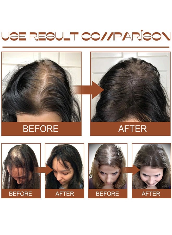 EELHOE - Batana Oil For Hair Growth Healthier Thicker Fuller Hair, Batana Oil, Batana Oil For Hair Growth, Batana Oil Organic, Batana Oil Organic For Healthy Hair, Batana Oil Hair Mask, 120ML - Image 1