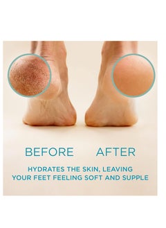 LEE Lee Beauty Professional Callus Remover for Feet - 8 Oz, Original, Powerful Formulation - Extra Strength Gel, Home Pedicure Foot Spa Results - Cracked & Dead Dry Skin Supplies  - Image 2