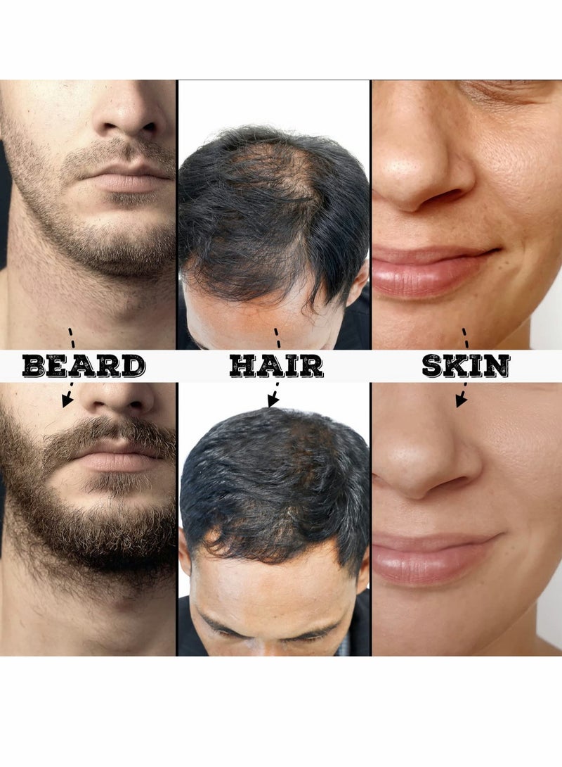 KASTWAVE Skin  Roller for Beard Hair Growth, 3 Pcs Beard Roller for Face Body Hair Skin (#0.5mm, Black) - Image 5