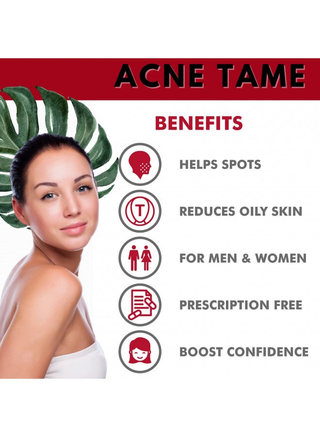 Acnetame Acne Tame- Acne Pills Supplement- Clear Skin Vitamins Pill for Oily Skin Treatment, Hormonal Blemishes, Anti Spots & Cystic Acnes Supplements for Women, Men, Teens & Adults- 60 Oral Tablets - Image 2