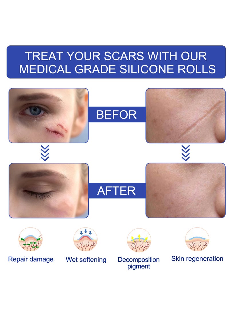 Elaimei - Silicone Scar Sheets 3M *4 cm Soft Silicone Gel  Scar Sticker Efficient Beauty Scars Removal - Image 1