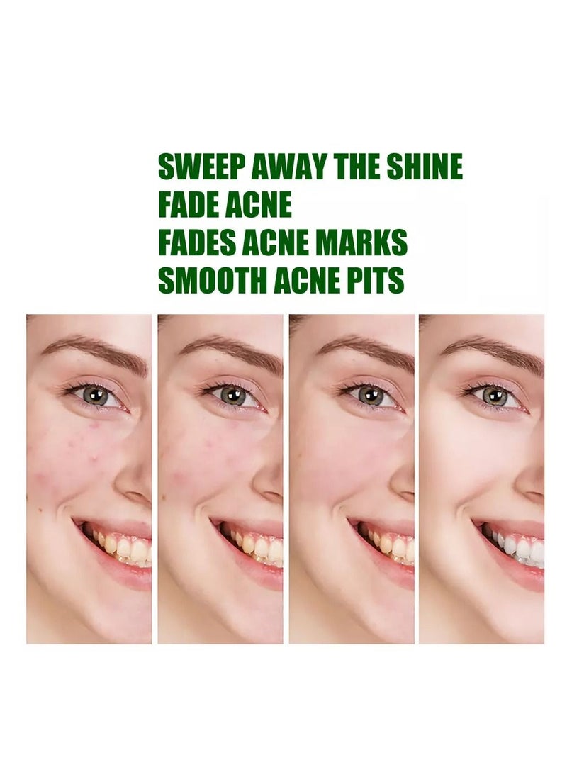 West&Month - 24 Patches Acne Pimple Patch Invisible Hydrocolloid Spot Skin Treatment for Face Fast Healing Transparent strong Adhesive Pimple Stickers - Image 1