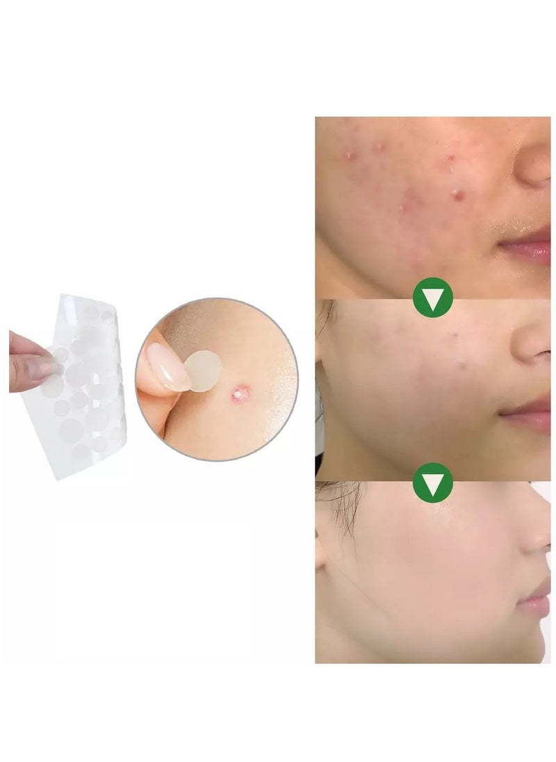 West&Month - 24 Patches Acne Pimple Patch Invisible Hydrocolloid Spot Skin Treatment for Face Fast Healing Transparent strong Adhesive Pimple Stickers - Image 1
