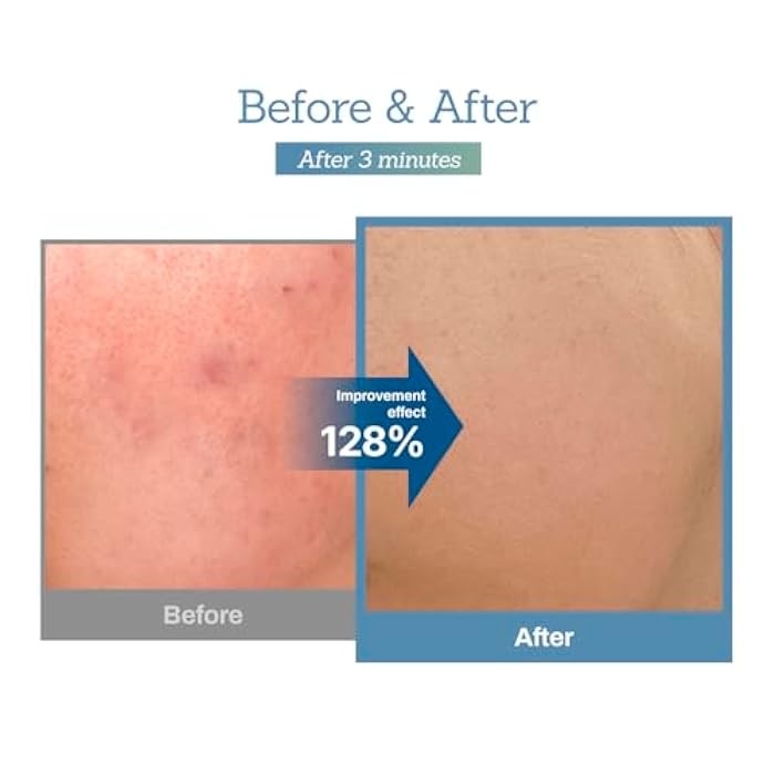 MEDITHERAPY Blue Centella Calming Cream - Hydrating Korean Face Moisturizer - Rapid Soothing Moisturizer Face Cream for All Types - Strengthening Skin Barrier for Glowing Skin - Non-Clogging Pore 3.38 fl oz. - Image 5