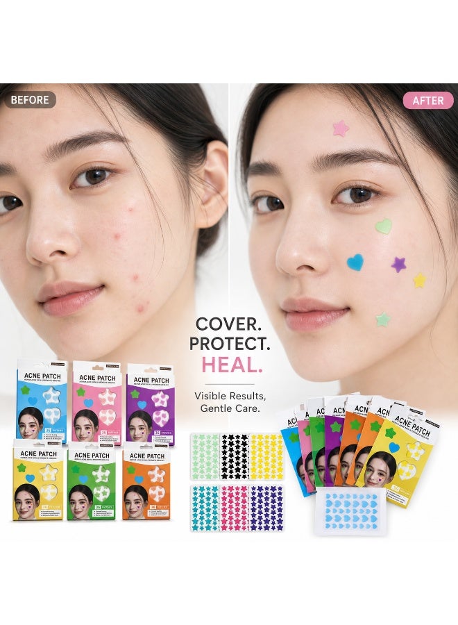 Acne patches are the ideal solution for caring for acne-prone skin. These patches feature an attractive, multi-colored, and multi-shaped design—a pack of 36 patches. - Image 2