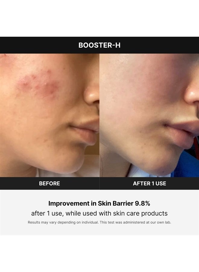 Medicube Age-R Booster H - Korean No.1 Skin Care Device - Facial Glow Booster for Maximizing and Boosting Skin Care Absorption - Needle Free  - Image 5