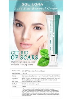 SOL LORA Acne Scar Removal Cream，Scar Erase ，Scar Removal Gel，Acne Scar Treatment，Deep Acne Scar Removal， Burns Keloids Hypertrophic， Repair Damaged Skin，Removing Acne  Scar Repair Cream，Stretchmarks Cream  - Image 5