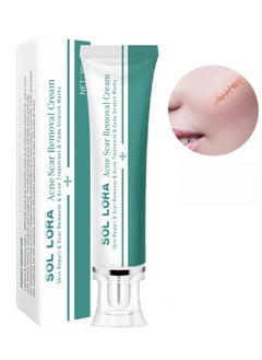 SOL LORA Acne Scar Removal Cream，Scar Erase ，Scar Removal Gel，Acne Scar Treatment，Deep Acne Scar Removal， Burns Keloids Hypertrophic， Repair Damaged Skin，Removing Acne  Scar Repair Cream，Stretchmarks Cream  - Image 2