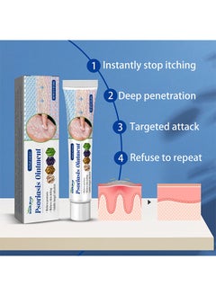 SOUTH MOON Herbal Extract Psoriasis Ointment, Dermatitis And Eczema Pruritus Psoriasis Ointment, Say Goodbye To Scaly Skin, Eczema Relief Ointment, Stops Burning And Itching 20g  - Image 2