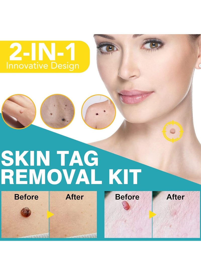 Elaimei Skin Tag Remover, FDA-Cleared Skin Tag Removal Kit Device, Safe and Effective Home Use  - Image 2