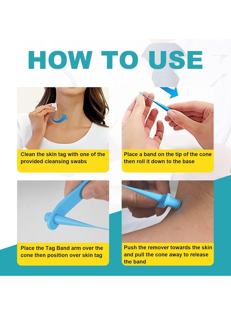 Elaimei Skin Tag Remover, FDA-Cleared Skin Tag Removal Kit Device, Safe and Effective Home Use  - Image 4