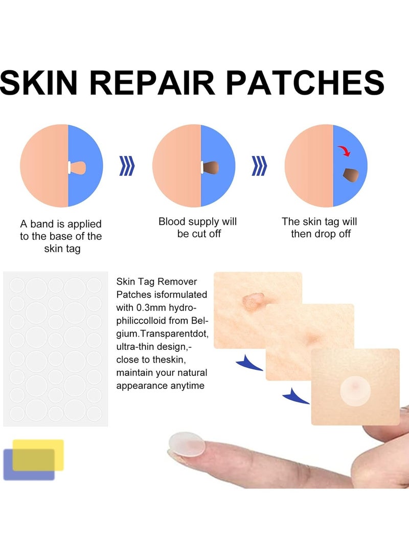 Elaimei Skin Tag Remover, FDA-Cleared Skin Tag Removal Kit Device, Safe and Effective Home Use  - Image 5