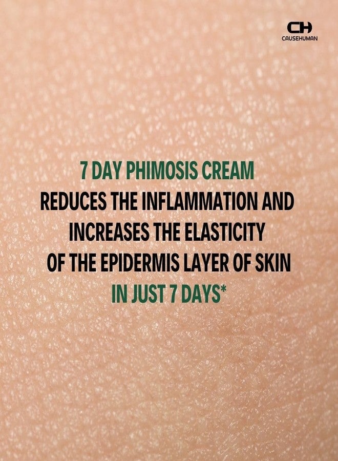 Cause Human 7-Day Phimosis Cream | Steroid-Free Treatment for Fast Relief at Home | Visible Results in 7 Days* | 3.16 fl oz (90g) | No Irritation | No Steroids (7 Day Phimosis Relief Cream) - Image 2